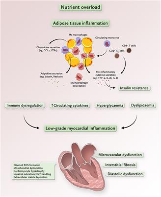 Inflammation in Metabolic Cardiomyopathy